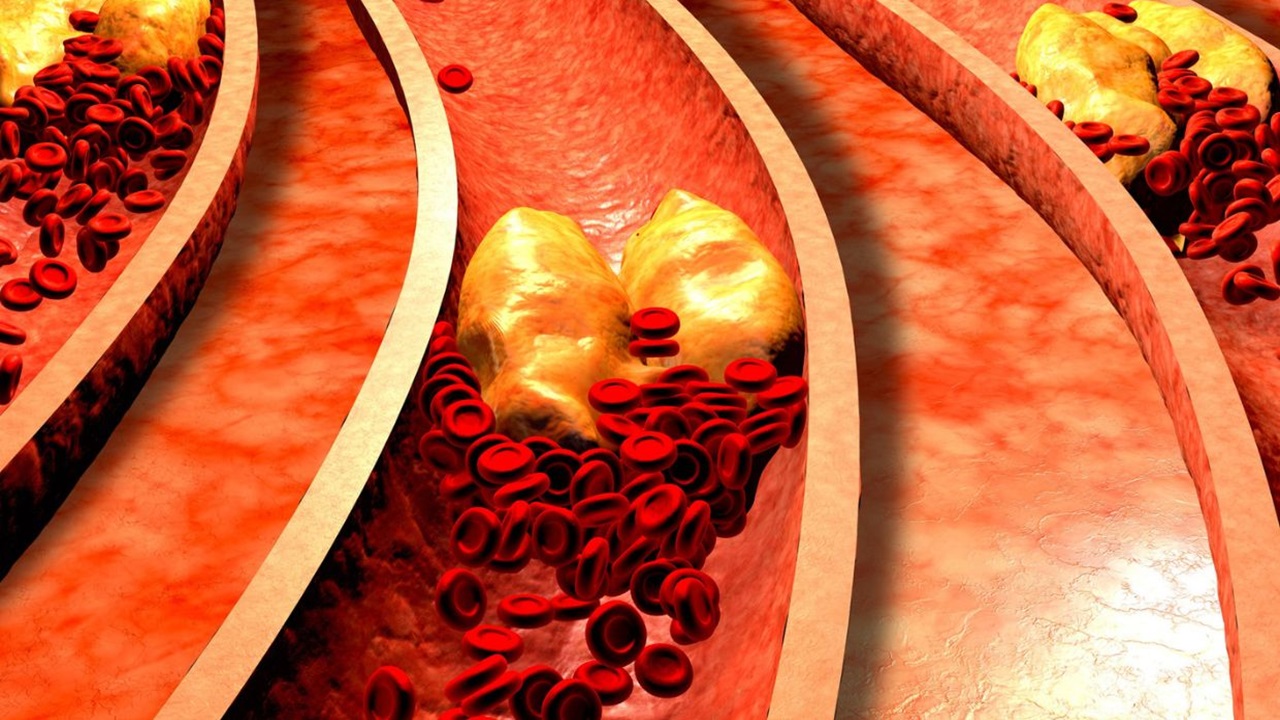 Nuevas opciones terapéuticas para la hipercolesterolemia familiar pediátrica